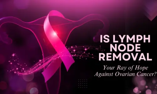 Ovarian Cancer