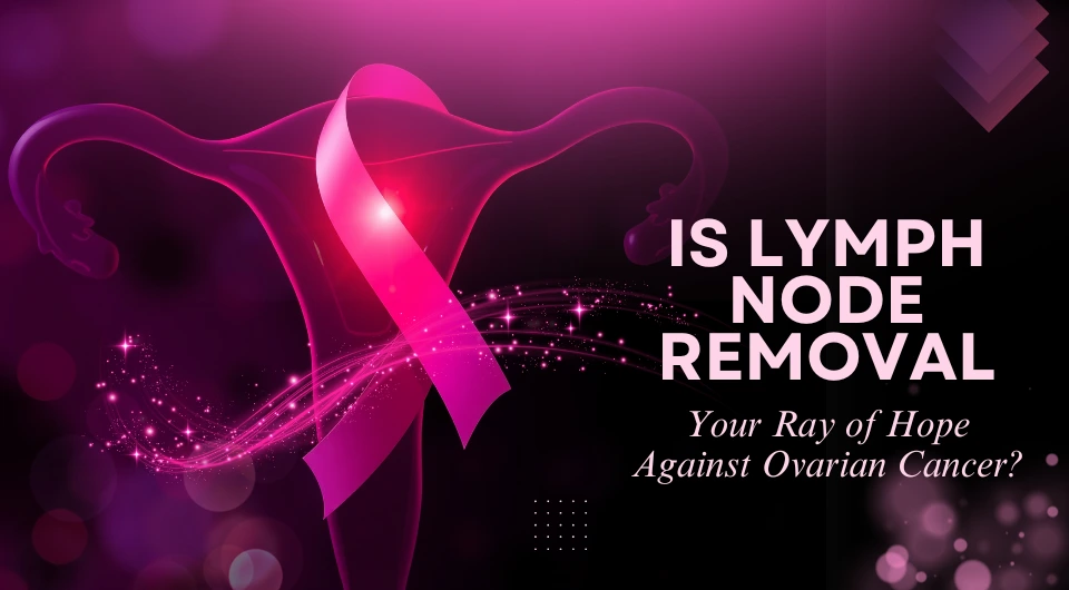 Ovarian Cancer