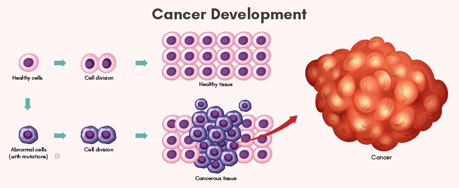  Lung Cancer