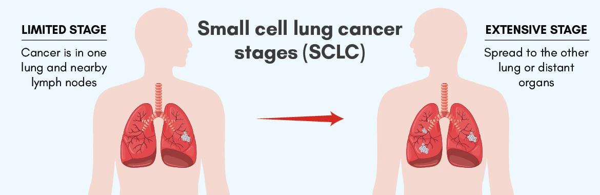 SCLC Lung Cancer